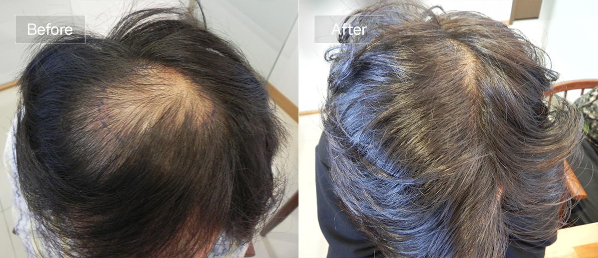 /filedata/md_board/20251229125823_vq8ebFcG_sub1_slide3.jpg 전후사진