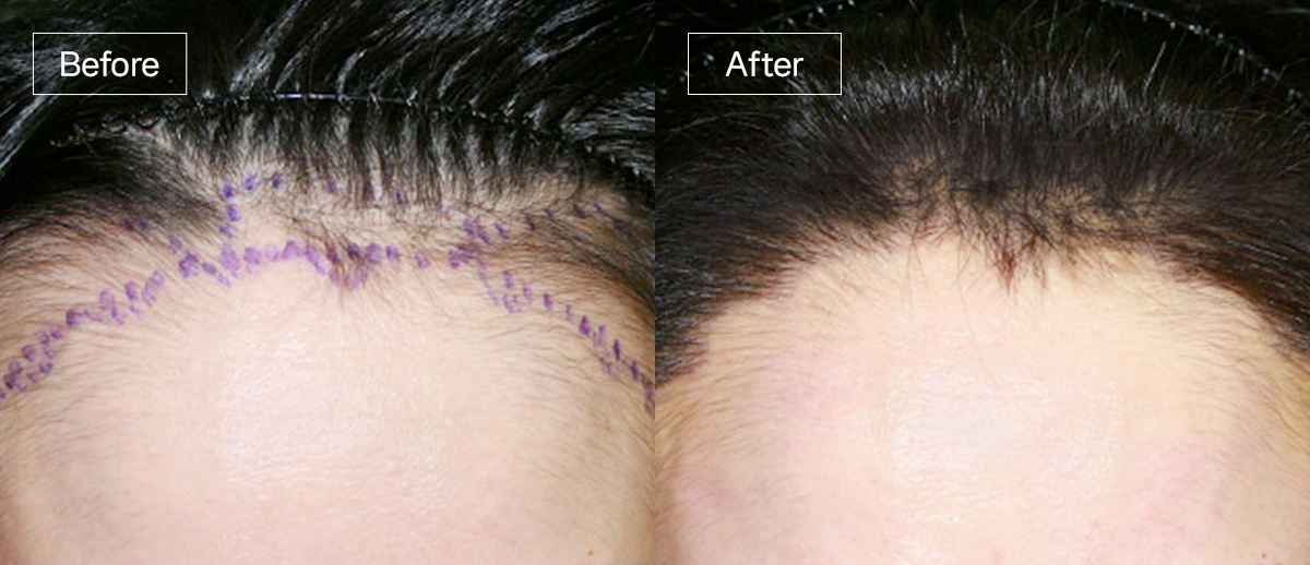 /filedata/md_board/20251229130057_V3cWYRIN_sub3_slide2.jpg 전후사진