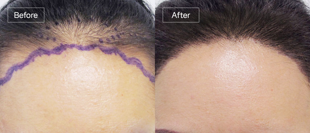 /filedata/md_board/20251229130117_YVfbaqI6_sub3_slide5.jpg 전후사진