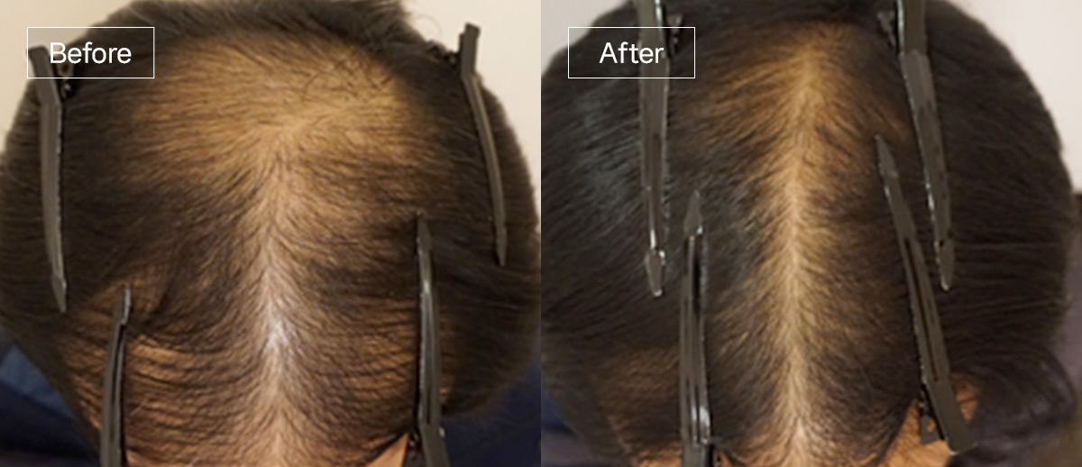 /filedata/md_board/20251229130228_JtuErMh2_sub4_slide1.jpg 전후사진