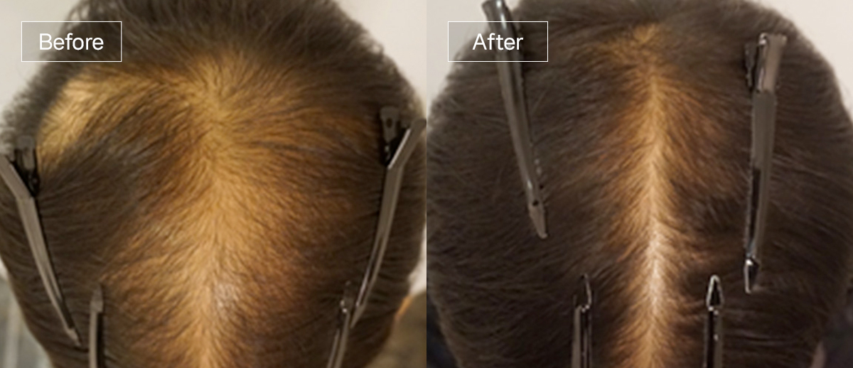 /filedata/md_board/20251229130235_Yi8bFelh_sub4_slide2.jpg 전후사진