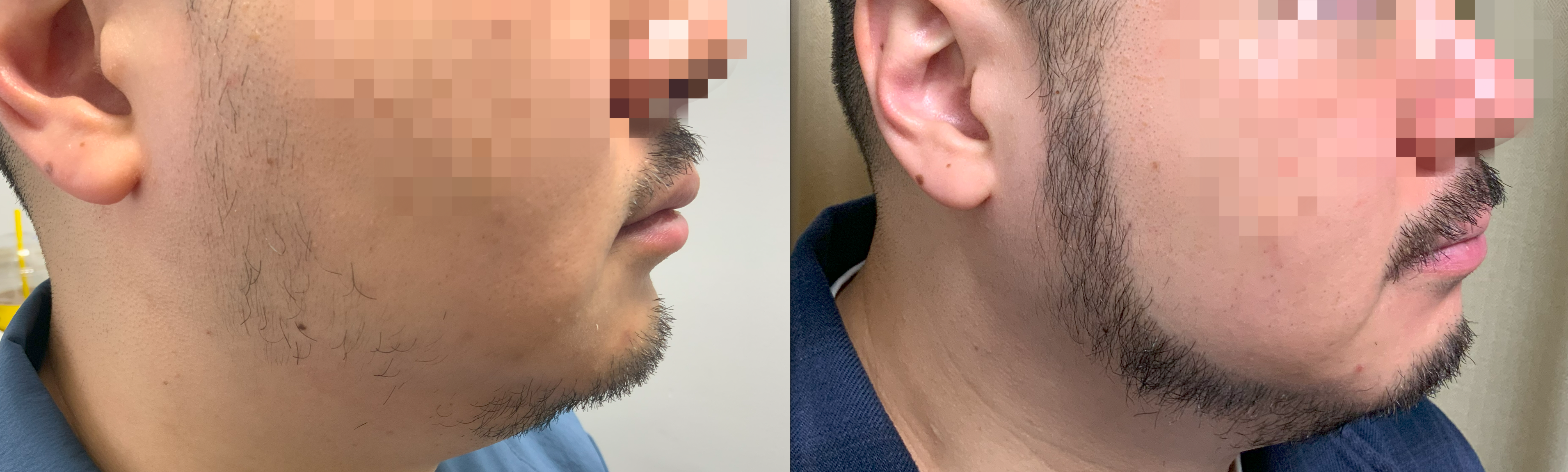 /filedata/md_board/20260129213448_C7UxVvzB_KakaoTalk_20260129_212949062_01.png 전후사진