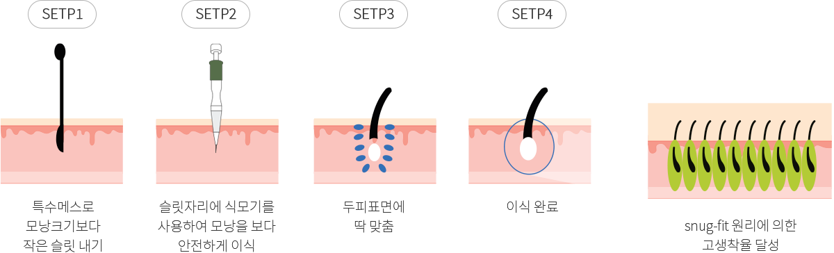 단계