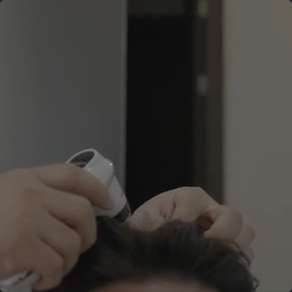 연세모벨르의원 탈모치료