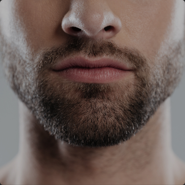 연세모벨르의원 기타부위이식